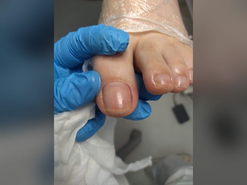 Atendimento podológico sendo realizado com luvas e material descartável